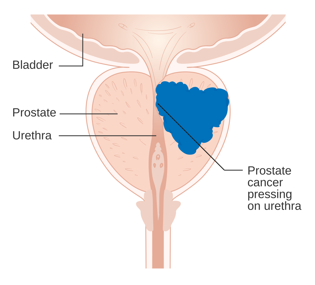 What are the warning signs of cancer