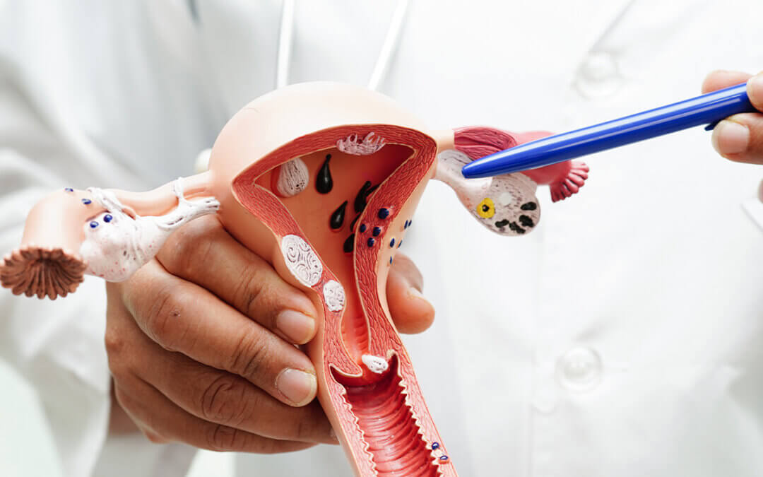 There are no foods that will prevent you from getting cancer, and no foods that will cure your cancer.